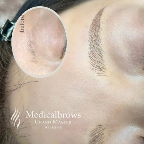 眉 7Dストローク CASE3